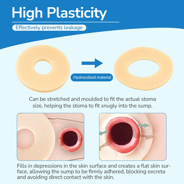 2 mm Ultra-Thin Stoma Leak-Proof Rings – 10-Pack Skin-Soft Seal, Instant Gap Fill & 24-Hr Zero-Leak Security