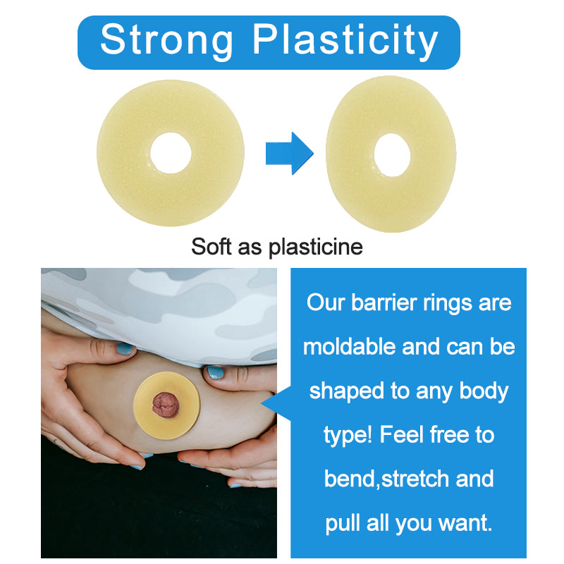 2 mm Ultra-Thin Stoma Leak-Proof Rings – 10-Pack Skin-Soft Seal, Instant Gap Fill & 24-Hr Zero-Leak Security