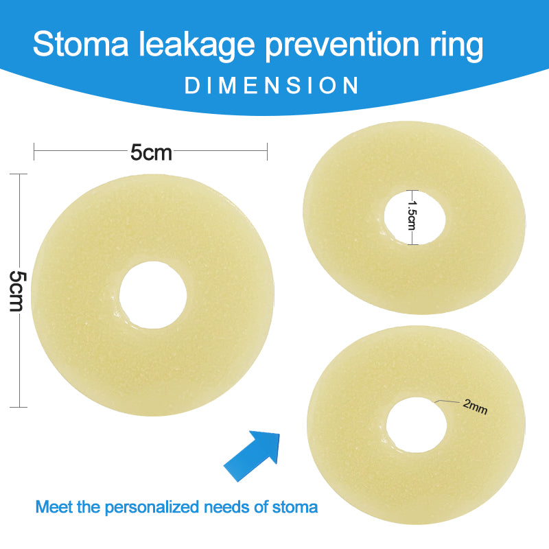 2 mm Ultra-Thin Stoma Leak-Proof Rings – 10-Pack Skin-Soft Seal, Instant Gap Fill & 24-Hr Zero-Leak Security