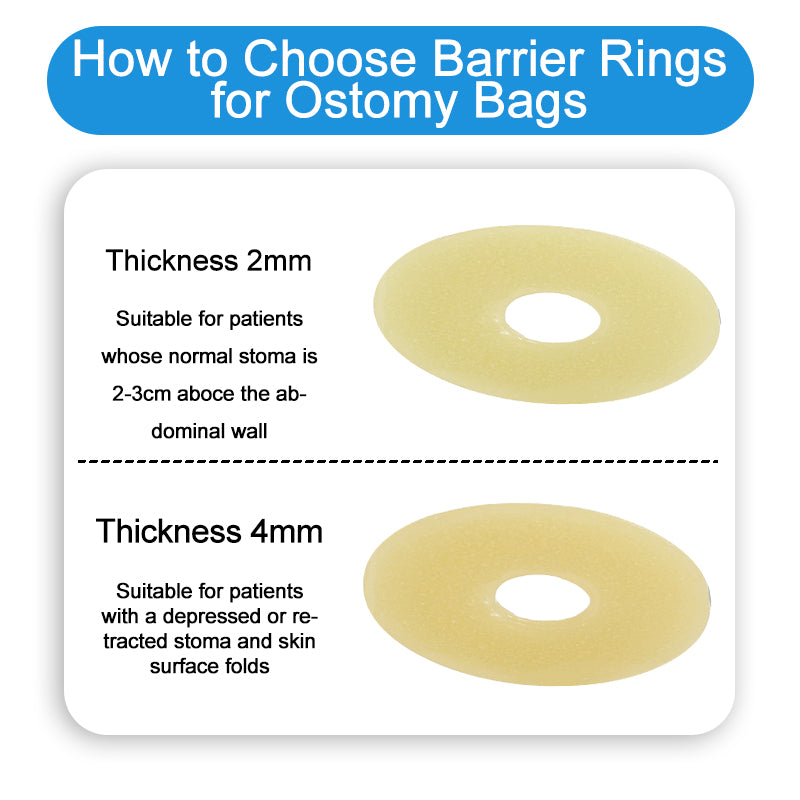 2 mm Ultra-Thin Stoma Leak-Proof Rings – 10-Pack Skin-Soft Seal, Instant Gap Fill & 24-Hr Zero-Leak Security