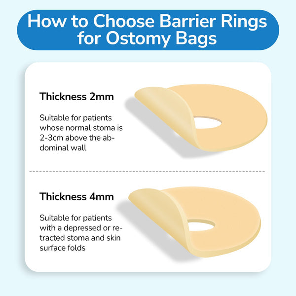 2 mm Ultra-Thin Stoma Leak-Proof Rings – 10-Pack Skin-Soft Seal, Instant Gap Fill & 24-Hr Zero-Leak Security